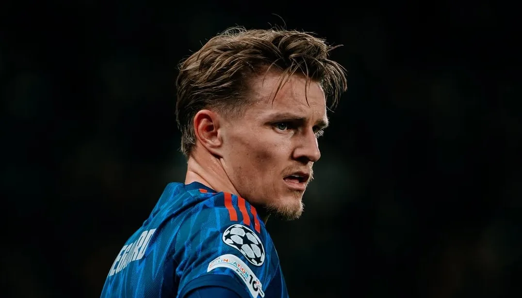 Martin Odegaard Konfirmasi Cedera Baru, Kabar Buruk bagi Arsenal Jelang Laga Kontra Man City