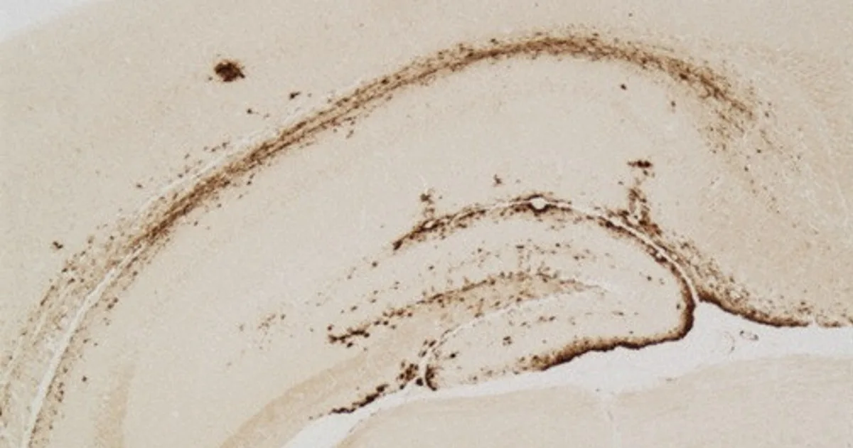 Ilmuwan Jepang Temukan 'Bibit' Pemicu Alzheimer yang Bisa Ditekan