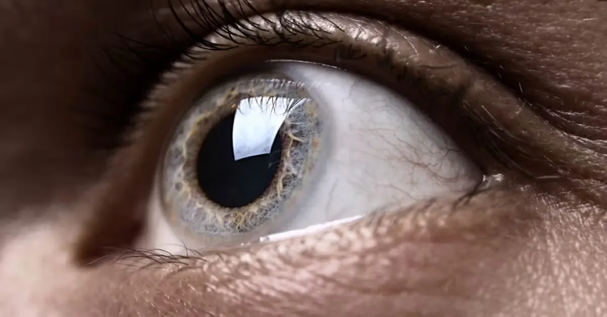 Retina Mata Bisa Jadi Alarm Dini AFib hingga 4 Tahun Sebelum Diagnosis